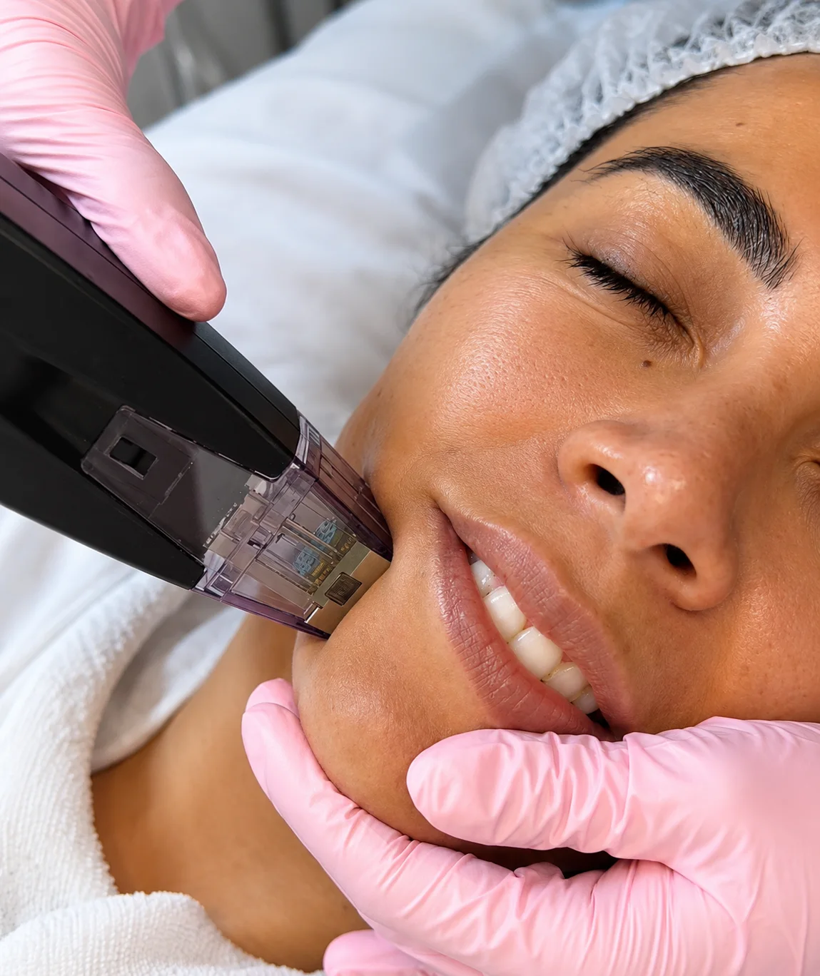 Primer plano de tratamiento facial con dispositivo y guantes protectores